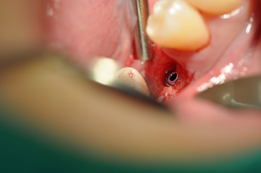 %_tempFileNameImplant%2093b2%
