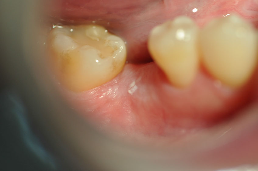 %_tempFileNameImplant%2093c1%