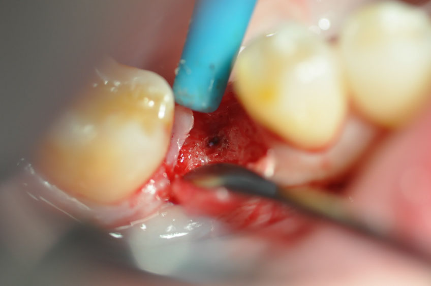 %_tempFileNameImplant%2093c2%