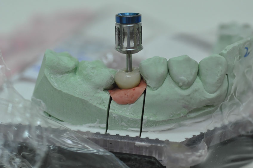%_tempFileNameImplant%2093d1%