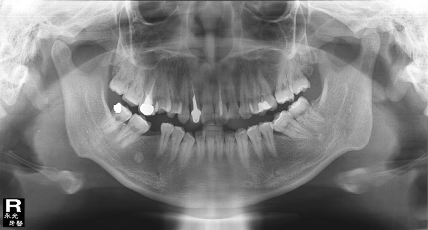 %_tempFileNameImplant%2093e1%