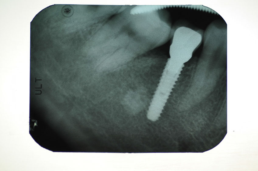 %_tempFileNameImplant%2093e3%