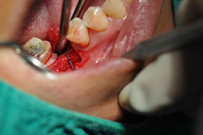 %_tempFileNameImplant%2094a2%