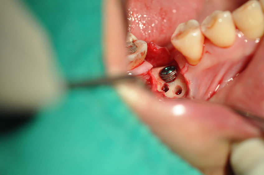 %_tempFileNameImplant%2094a3%