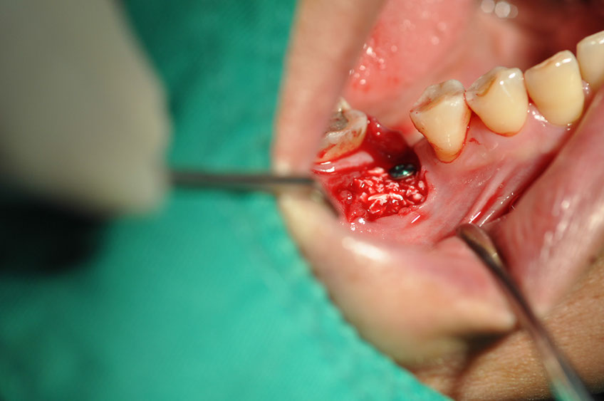 %_tempFileNameImplant%2094a4%