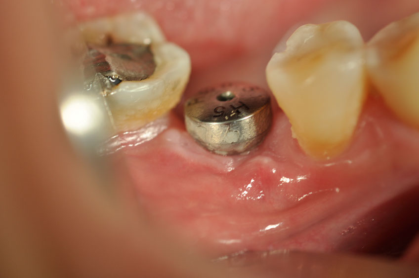 %_tempFileNameImplant%2094b1%