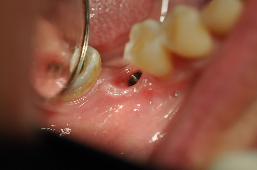 %_tempFileNameImplant%2094b2%