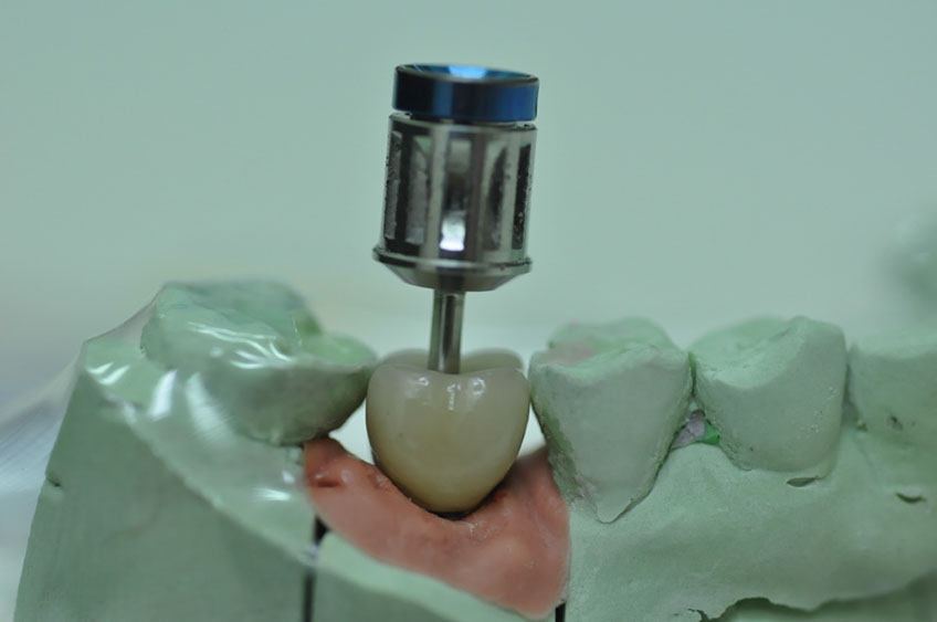 %_tempFileNameImplant%2094b3%