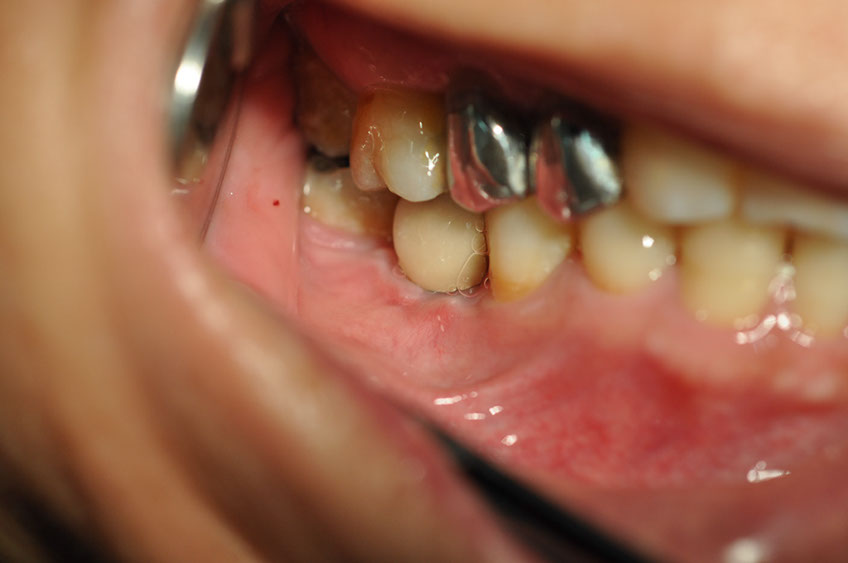 %_tempFileNameImplant%2094c2%