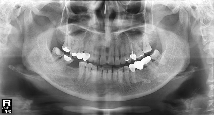 %_tempFileNameImplant%2094d1%