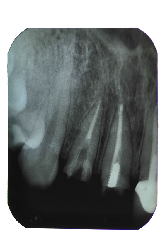 %_tempFileNameImplant%2095a4%