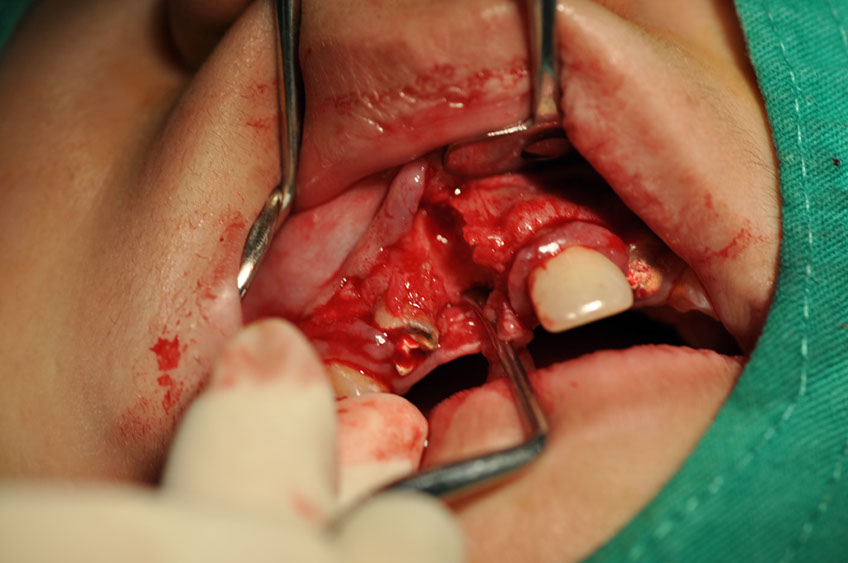 %_tempFileNameImplant%2095b2%