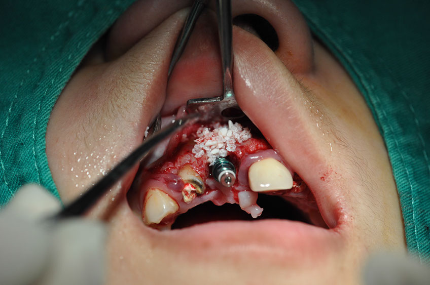 %_tempFileNameImplant%2095c2%