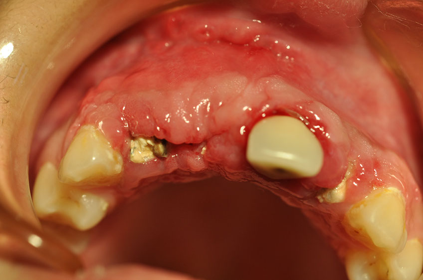 %_tempFileNameImplant%2095c5%