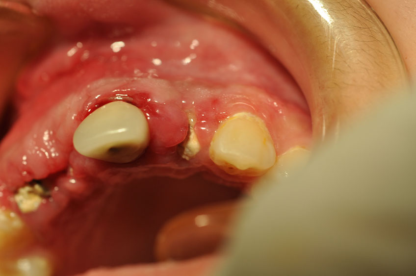 %_tempFileNameImplant%2095c6%