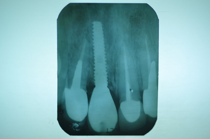 %_tempFileNameImplant%2095d4%