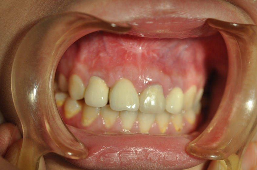 %_tempFileNameImplant%2095e1%