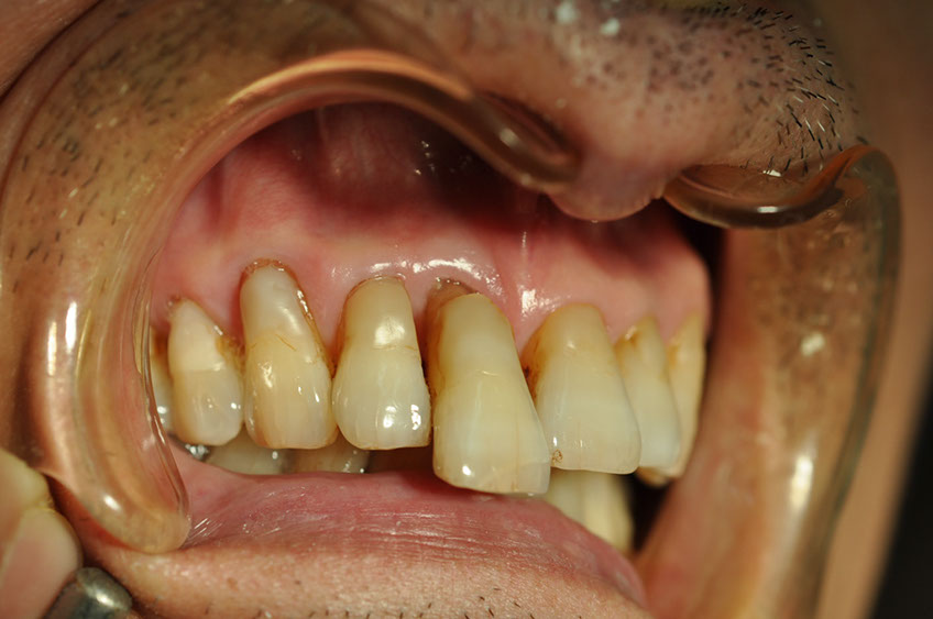 %_tempFileNameImplant%2096a1%