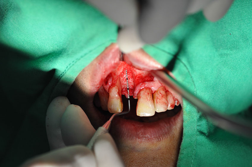 %_tempFileNameImplant%2096a3%