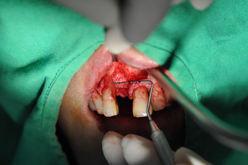 %_tempFileNameImplant%2096a4%