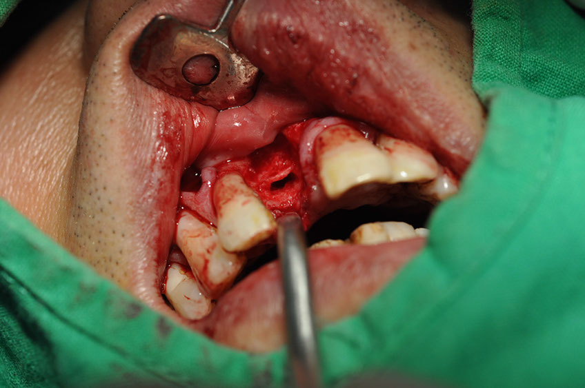 %_tempFileNameImplant%2096a5%