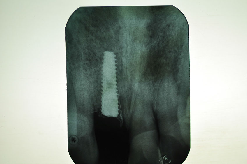 %_tempFileNameImplant%2096b3%