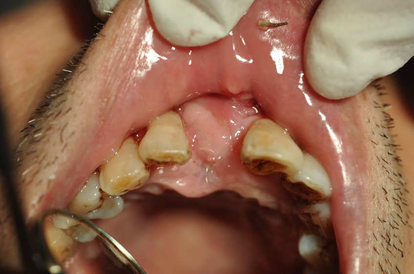 %_tempFileNameImplant%2096c1%
