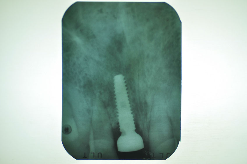 %_tempFileNameImplant%2096c5%