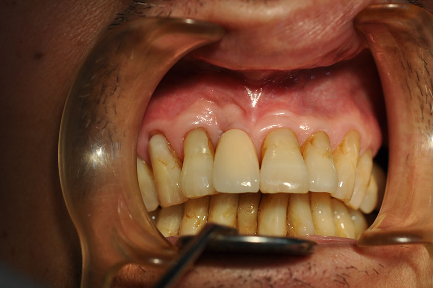 %_tempFileNameImplant%2096d1%