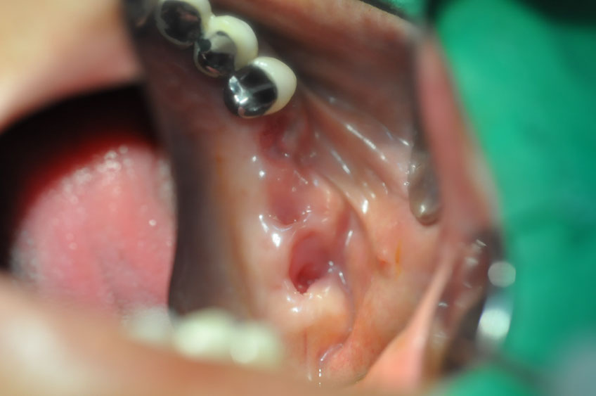 %_tempFileNameImplant%2098a1%