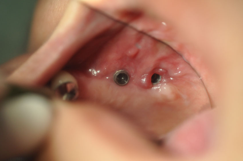 %_tempFileNameImplant%2098b1%