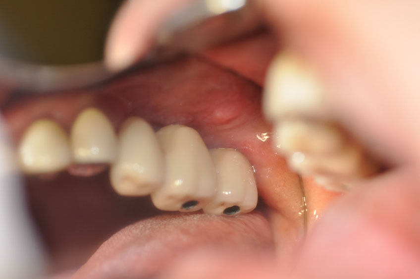 %_tempFileNameImplant%2098c1%