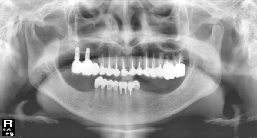 %_tempFileNameImplant%2098d2%