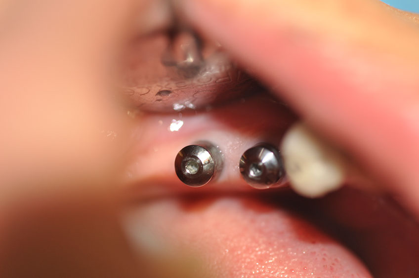 %_tempFileNameImplant%2099a2%