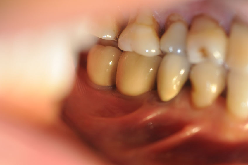 %_tempFileNameImplant%2099c3%