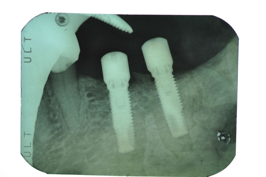 %_tempFileNameImplant%2099d1%