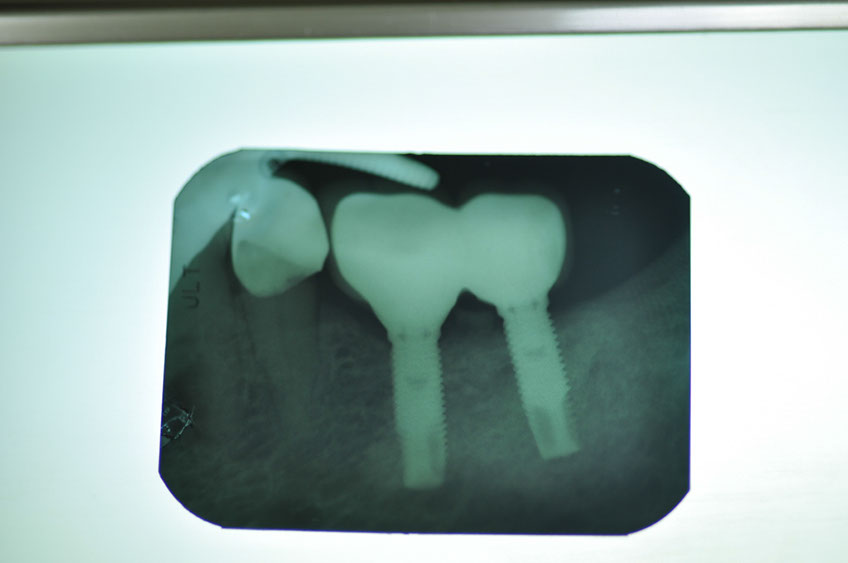 %_tempFileNameImplant%2099d2%