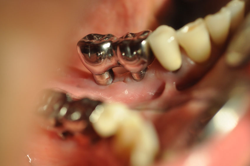 %_tempFileNameImplant%2099d4%