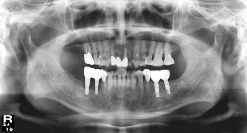 %_tempFileNameImplant%2099d5%