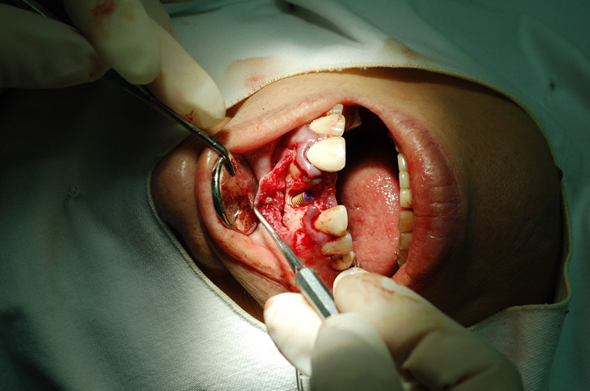 %_tempFileNameImplant%209d1%