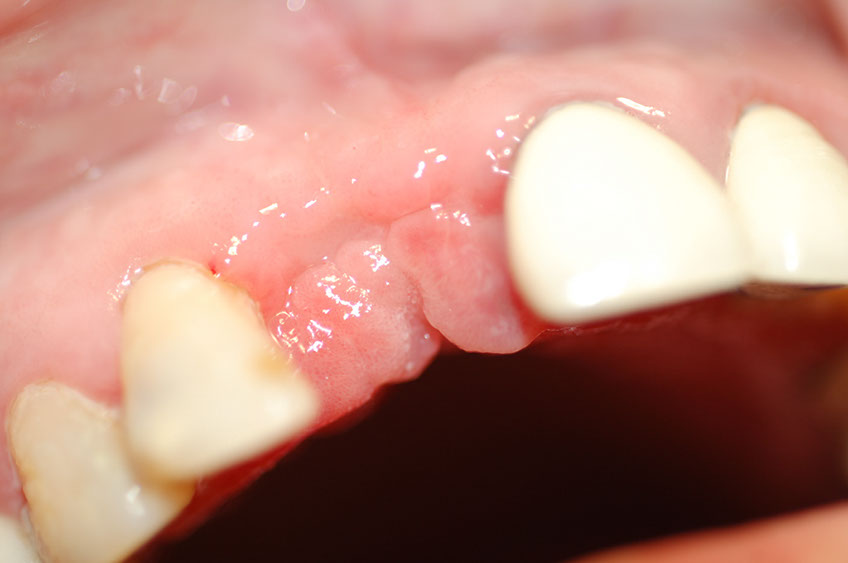 %_tempFileNameImplant%209i1%