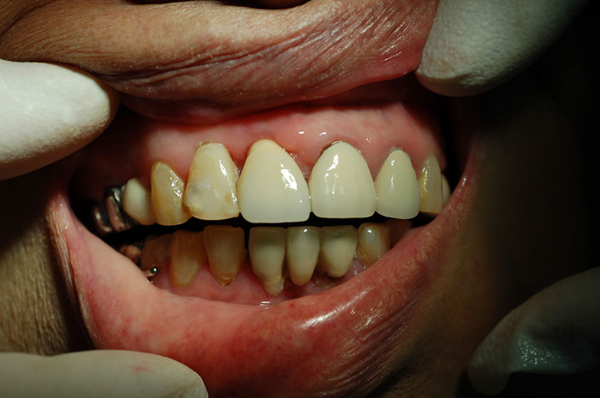 %_tempFileNameImplant%209j1%