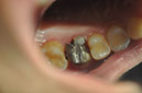 %_tempFileNameIMplant%20108a1%