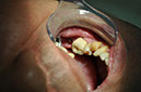 %_tempFileNameIMplant%2034c%