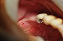 %_tempFileNameIMplant%2040a1%