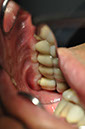 %_tempFileNameIMplant%2040b7%