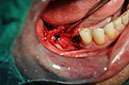 %_tempFileNameIMplant%2040c2%