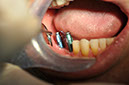 %_tempFileNameIMplant%2040c5%