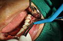 %_tempFileNameIMplant%2058a3%