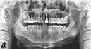 %_tempFileNameIMplant%2061d4%